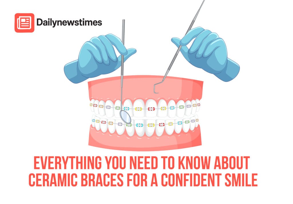 Ceramic braces